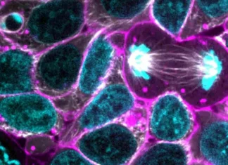 Cellular metabolism: what it is, how it works and types