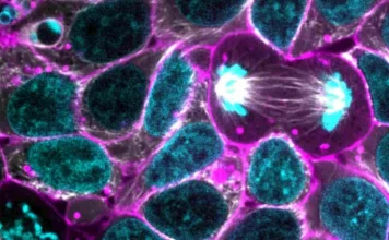 Cellular metabolism: what it is, how it works and types