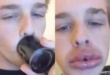 The 12 stupidest fashions that have accompanied us throughout history