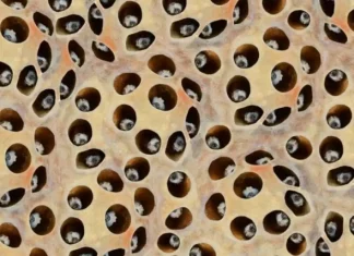 Trypophobia: what it is and 5 images to understand it