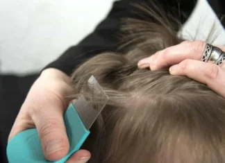 How to get rid of lice: 6 effective solutions